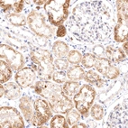 Immunohistochemical staining of human kidney shows moderate granular cytoplasmic positivity in cells in tubules.