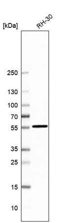 Western blot analysis in human cell line RH-30.