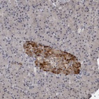 Anti-RC3H1 Antibody