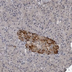 Anti-RC3H1 Antibody