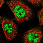 Immunofluorescent staining of human cell line A-431 shows localization to nucleoplasm.