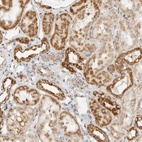 Anti-RC3H1 Antibody