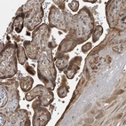 Immunohistochemical staining of human placenta shows moderate cytoplasmic positivity in trophoblastic cells.