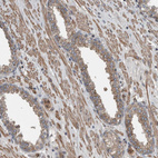 Immunohistochemical staining of human prostate shows moderate cytoplasmic positivity in smooth muscle cells.