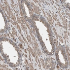Immunohistochemical staining of human prostate shows moderate cytoplasmic positivity in smooth muscle cells.