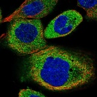 Immunofluorescent staining of human cell line A-431 shows localization to cytosol.
