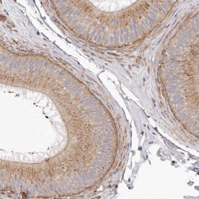 Anti-VPS45 Antibody