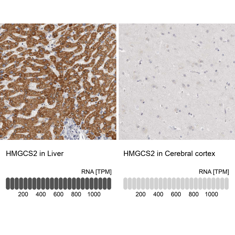 Anti-HMGCS2 Antibody