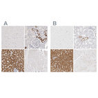 Immunohistochemical staining of human cerebral cortex, kidney, liver and skeletal muscle using Anti-HMGCS2 antibody HPA027442 (A) shows similar protein distribution across tissues to independent antibody HPA027423 (B).
