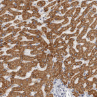 Immunohistochemical staining of human liver shows strong granular cytoplasmic positivity in hepatocytes.