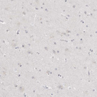 Immunohistochemical staining of human cerebral cortex shows no positivity in neurons as expected.