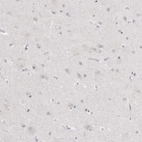 Immunohistochemical staining of human cerebral cortex shows no positivity in neurons as expected.