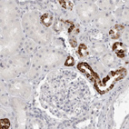 Immunohistochemical staining of human kidney shows strong granular cytoplasmic positivity in cells in tubules.