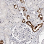 Immunohistochemical staining of human kidney shows strong granular cytoplasmic positivity in cells in tubules.