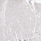 Immunohistochemical staining of human skeletal muscle shows no positivity in myocytes as expected.