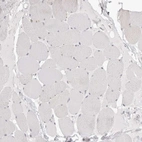 Immunohistochemical staining of human skeletal muscle shows no positivity in myocytes as expected.