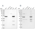 Western blot analysis using Anti-HMGCS2 antibody HPA027442 (A) shows similar pattern to independent antibody HPA027423 (B).