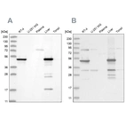 Western blot analysis using Anti-HMGCS2 antibody HPA027442 (A) shows similar pattern to independent antibody HPA027423 (B).