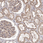 Anti-ALPK1 Antibody