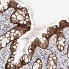 Immunohistochemical staining of human rectum shows high expression.