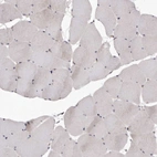 Immunohistochemical staining of human skeletal muscle shows low expression as expected.