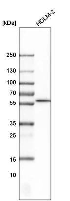 Western blot analysis in human cell line HDLM-2.