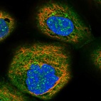 Immunofluorescent staining of human cell line A-431 shows localization to nuclear bodies, plasma membrane & cytosol.