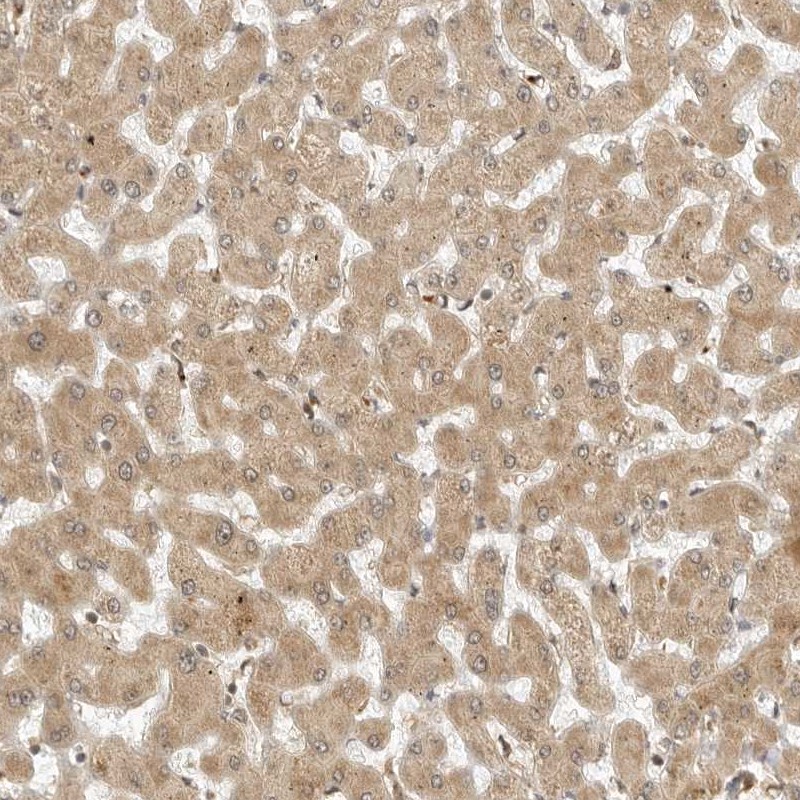 Anti-RC3H1 Antibody