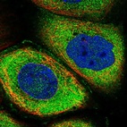 Immunofluorescent staining of human cell line A-431 shows localization to plasma membrane & cytosol.