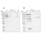 Anti-PUM1 Antibody