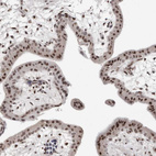 Immunohistochemical staining of human placenta shows strong nuclear positivity in trophoblastic cells.