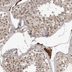 Immunohistochemical staining of human testis shows moderate nuclear positivity in cells in seminiferous ducts.