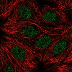 Immunofluorescent staining of human cell line MCF7 shows localization to nucleoplasm.