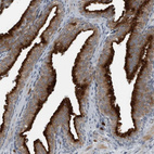 Immunohistochemical staining of human Prostate shows strong granular cytoplasmic positivity in glandular cells.