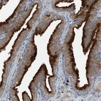Immunohistochemical staining of human Prostate shows strong granular cytoplasmic positivity in glandular cells.