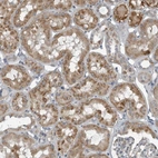 Immunohistochemical staining of human Kidney shows moderate granular cytoplasmic positivity in cells in tubules.