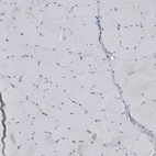 Immunohistochemical staining of human Skeletal muscle shows no granular cytoplasmic positivity in myocytes.