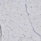 Immunohistochemical staining of human Skeletal muscle shows no granular cytoplasmic positivity in myocytes.