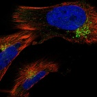 Immunofluorescent staining of human cell line U-251 MG shows localization to the Golgi apparatus & vesicles.