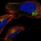 Immunofluorescent staining of human cell line U-251 MG shows localization to the Golgi apparatus & vesicles.