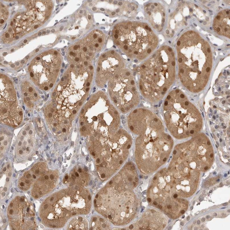 Anti-UROD Antibody