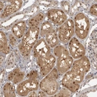 Anti-UROD Antibody
