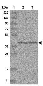 Lane 1: Marker [kDa] 230, 130, 95, 72, 56, 36, 28, 17, 11_br/_Lane 2: Human cell line RT-4_br/_Lane 3: Human cell line U-251MG sp