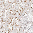 Immunohistochemical staining of human kidney shows strong membranous positivity in cells in tubules.