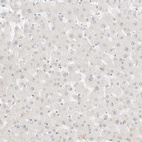 Immunohistochemical staining of human liver shows no membranous positivity in hepatocytes as expected.