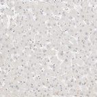 Immunohistochemical staining of human liver shows no membranous positivity in hepatocytes as expected.