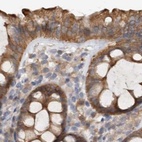 Immunohistochemical staining of human colon using Anti-UFC1 antibody HPA027481.