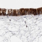 Immunohistochemical staining of human nasopharynx using Anti-UFC1 antibody HPA027481.