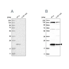 Western blot analysis using Anti-UFC1 antibody HPA027481 (A) shows similar pattern to independent antibody HPA028722 (B).