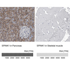 Anti-SPINK1 Antibody
